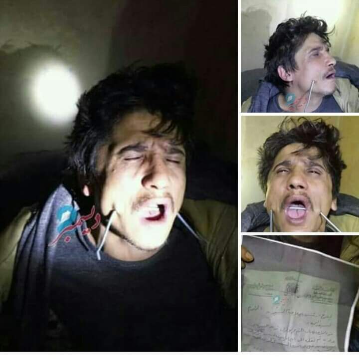 صورة ارشيفيه لسجين في احد معتقلات مليشبا الحوثي