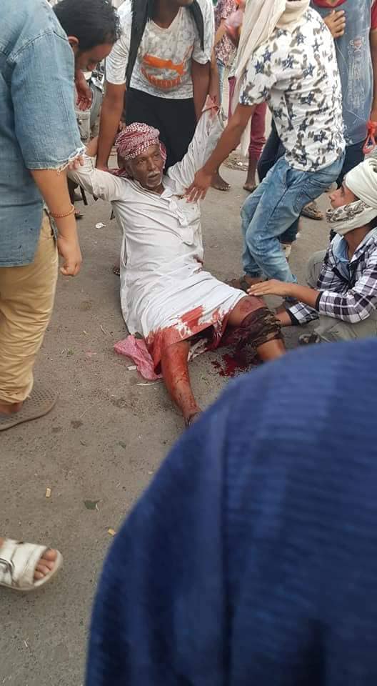 جريح في إنفجار التواهي